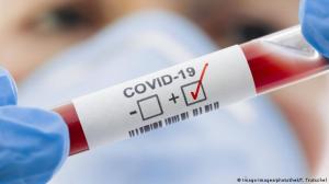 В Украине больше 20 тысяч новых случаев COVID-19 за сутки